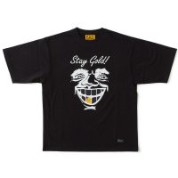 FAT/STAY GOLD  BLACK